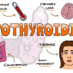 How To Unravel the Mystery of Thyroid Disease